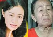 Belle doubt is like contract premature senility disease, 26 years old look like 70 years old of old
