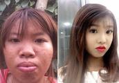 Vietnam is ugly female break heavy gold face-lifting laugh is married rich 2 generation, her pay is