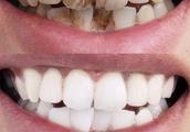 Increasing person need not toothpaste is clean, be brushed every day or fizzle out smelly, instruct