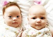 British couple is delivered of " infrequent twin 