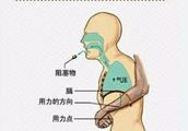 Child foreign body blocks larynx: Do not pat back! Help a person one action of emergency treatment l