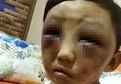 4 years old male child meet with one's own mother is cruel dozen, yi Nengjing late night reprimand