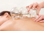 What advantage and disadvantage does cupping have?