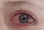 Psychology checks: Which eye had just cried? Measu