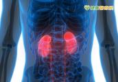 Man arthralgia eats anodyne unexpectedly systemic oedema danger washs kidney